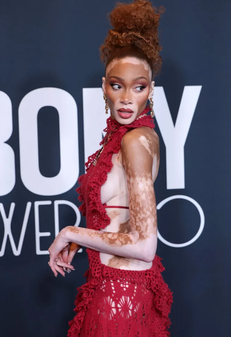 O njoj uvijek pričaju svi! Winnie Harlow zasjala na crvenom tepihu u neodoljivom izdanju koje oduzima dah