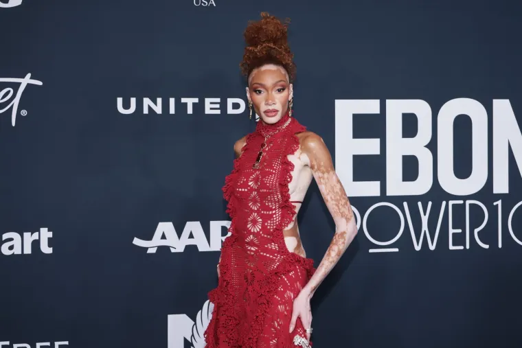 O njoj uvijek pričaju svi! Winnie Harlow zasjala na crvenom tepihu u neodoljivom izdanju koje oduzima dah