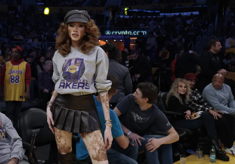 O njoj uvijek pričaju svi! Winnie Harlow zasjala na crvenom tepihu u neodoljivom izdanju koje oduzima dah