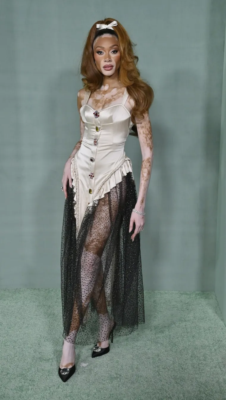 O njoj uvijek pričaju svi! Winnie Harlow zasjala na crvenom tepihu u neodoljivom izdanju koje oduzima dah