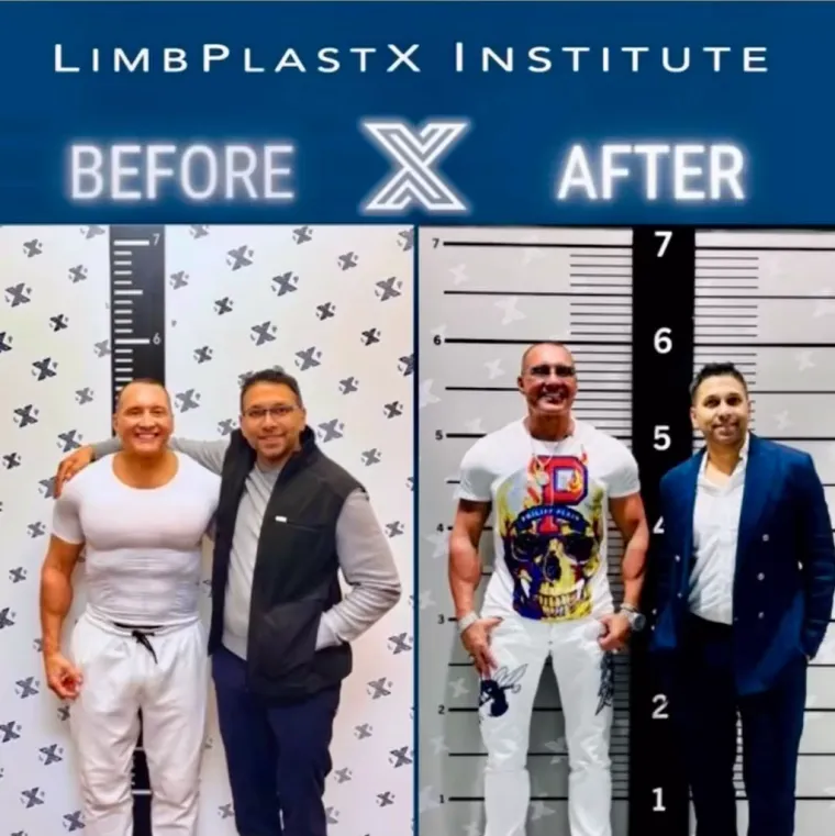 Dao je bogatstvo kako bi od njega napravili visokog mu&scaron;karca: Proživio je pakao, i nije mu dosta