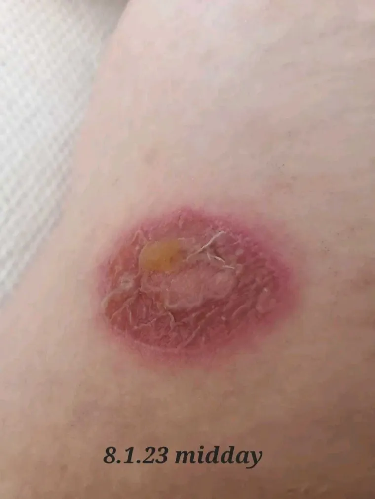 Prisiljena je živjeti život vampirice jer je može ubiti samo jedna minuta na suncu