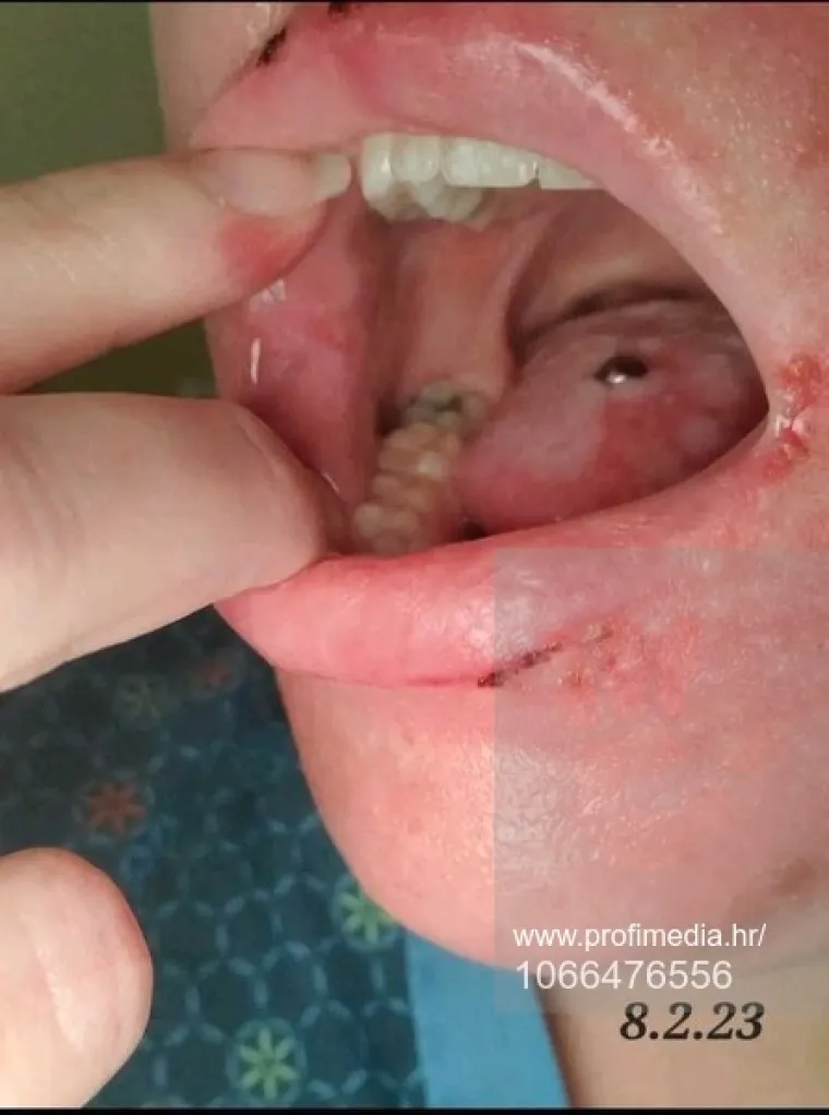 Prisiljena je živjeti život vampirice jer je može ubiti samo jedna minuta na suncu