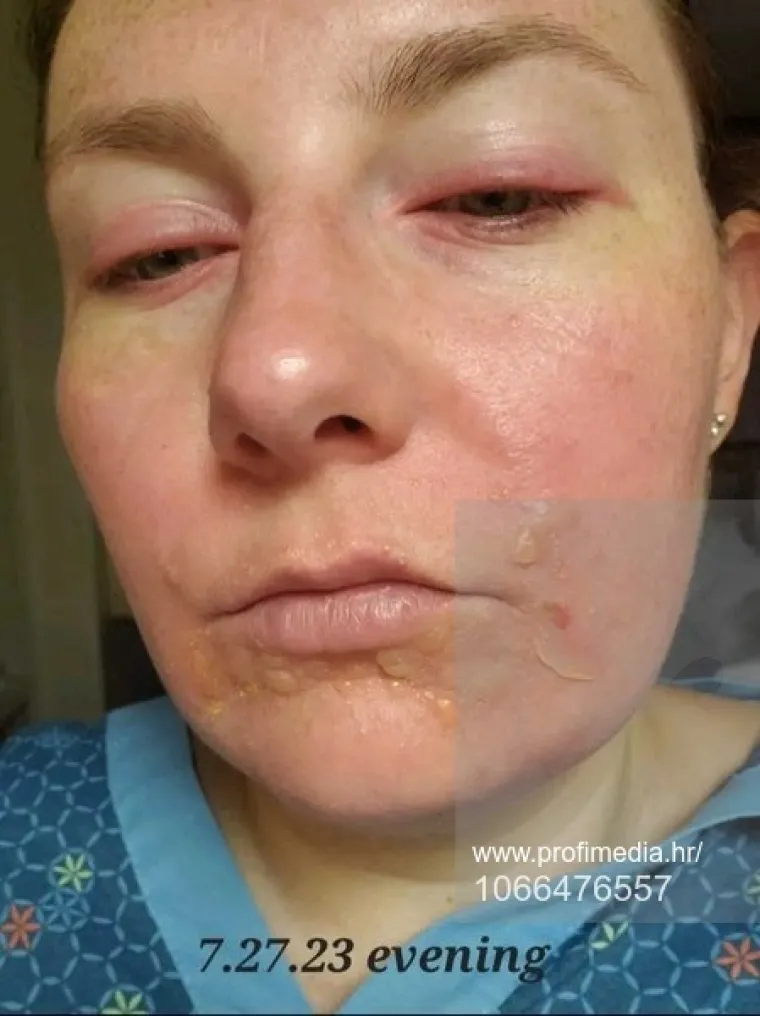 Prisiljena je živjeti život vampirice jer je može ubiti samo jedna minuta na suncu