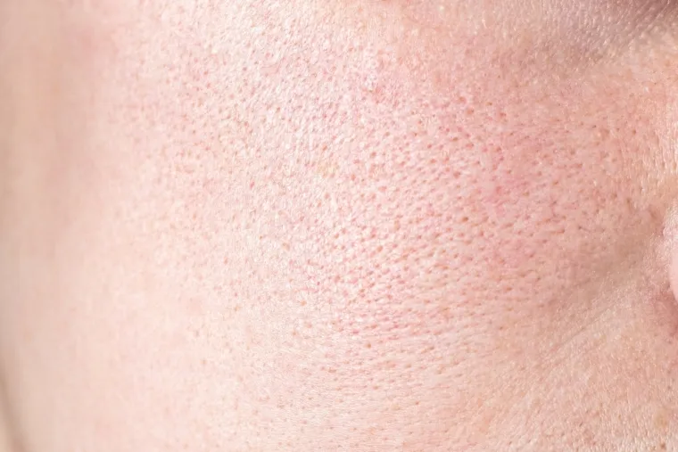 &Scaron;to se događa s tijelom ako se prestanete prati? Ovih 25 posljedica je alarmantno