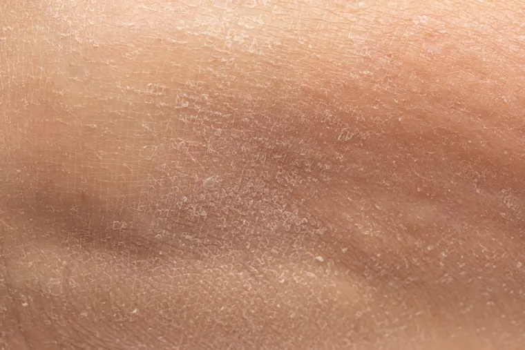 &Scaron;to se događa s tijelom ako se prestanete prati? Ovih 25 posljedica je alarmantno