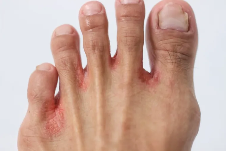 &Scaron;to se događa s tijelom ako se prestanete prati? Ovih 25 posljedica je alarmantno