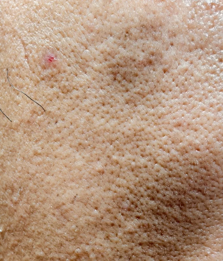 &Scaron;to se događa s tijelom ako se prestanete prati? Ovih 25 posljedica je alarmantno