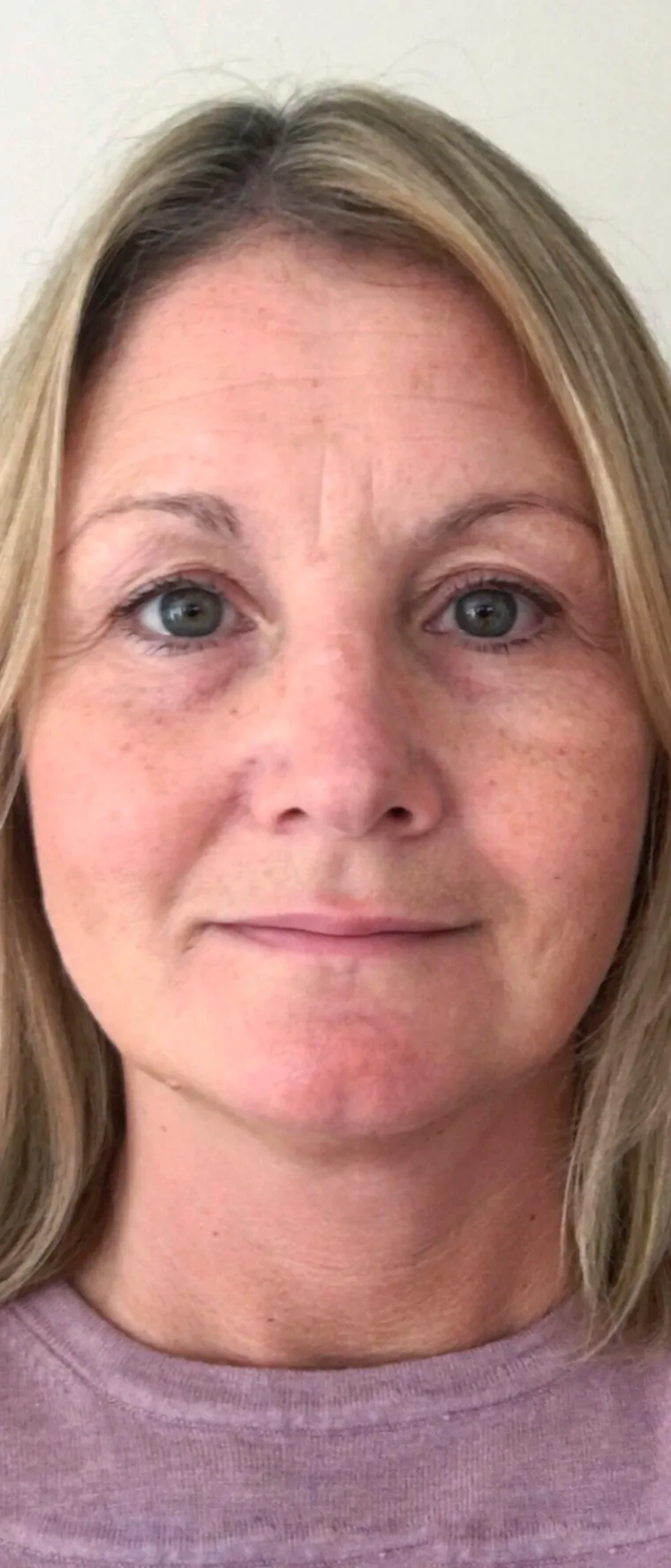 Žene podijelile čudesne transformacije: Nevjerojatno koliko &scaron;minka može promijeniti osobu