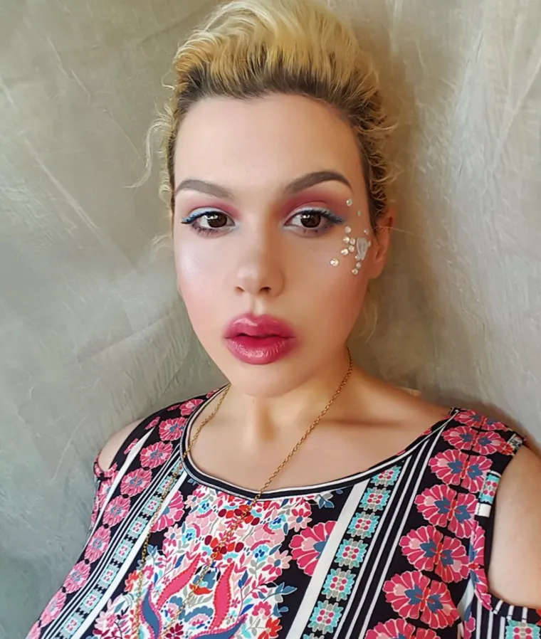 Zbog prekomjernih kilograma nije mogla hodati, a onda je napravila čudo: Danas izgleda sjajno