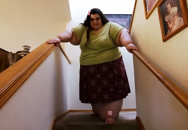 Zbog prekomjernih kilograma nije mogla hodati, a onda je napravila čudo: Danas izgleda sjajno