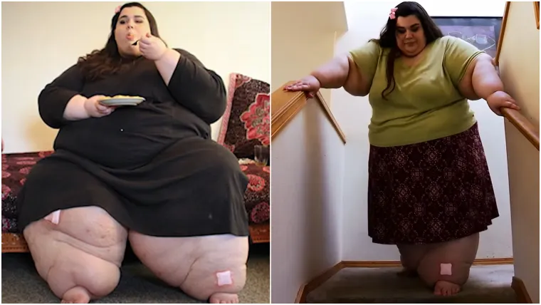 Zbog prekomjernih kilograma nije mogla hodati, a onda je napravila čudo: Danas izgleda sjajno