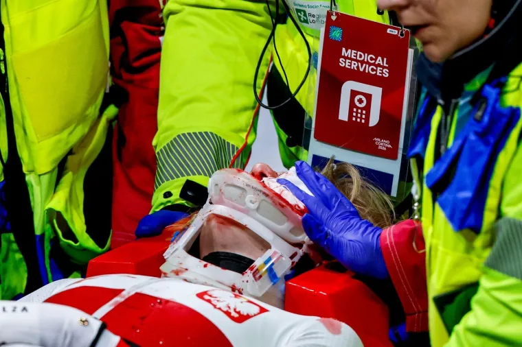 Stra&scaron;ne scene: Bri&scaron;e se krv s leda, klizaljka joj prerezala lice, dvorana zanijemila