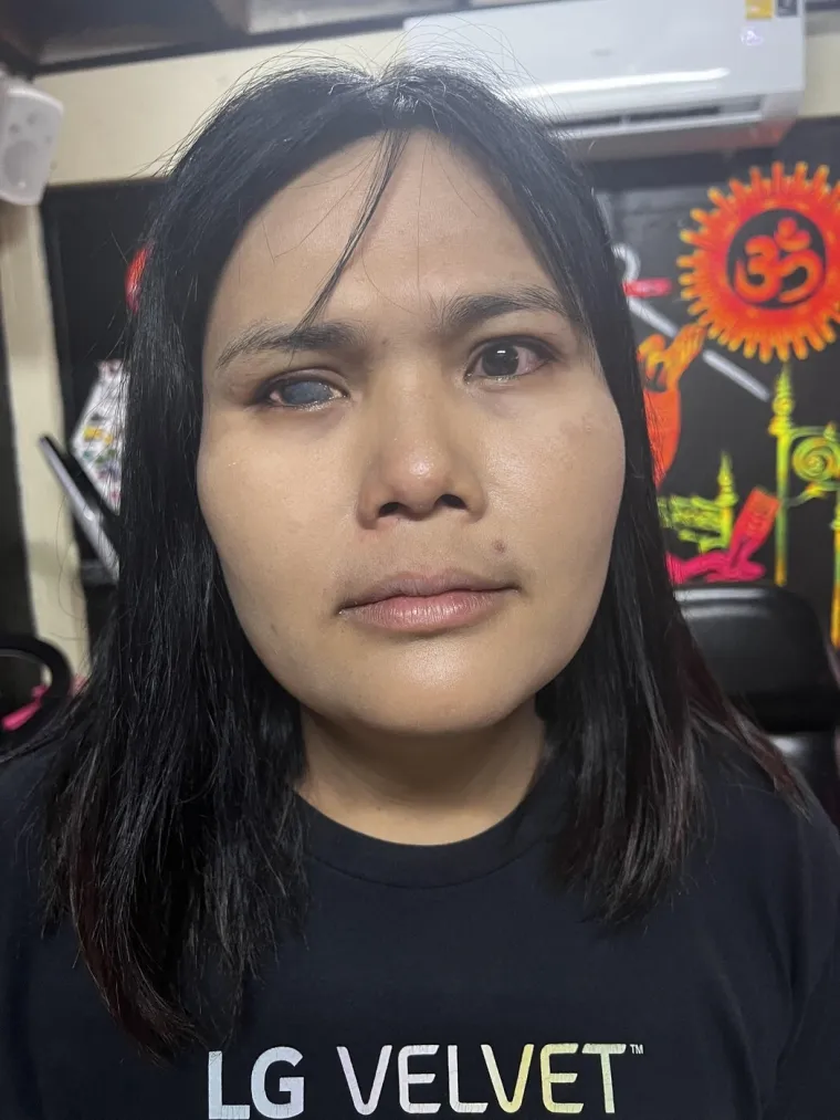 Transrodna umjetnica klijentici istetovirala slijepo oko: Rezultat je čudesan