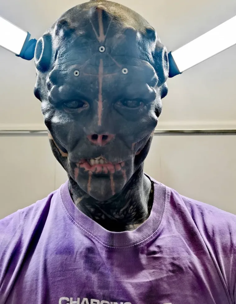 Bio je ba&scaron; zgodan mu&scaron;karac, a onda je od sebe napravio izvanzemaljca: Evo kako danas izgleda