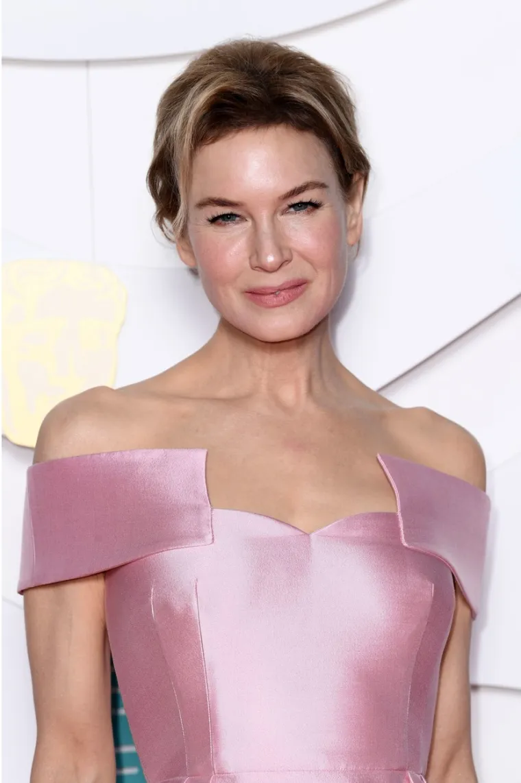 Bridget Jones, jesi to ti? Legendarnu glumicu mnogi vi&scaron;e ne prepoznaju, pretjerala sa zahvatima