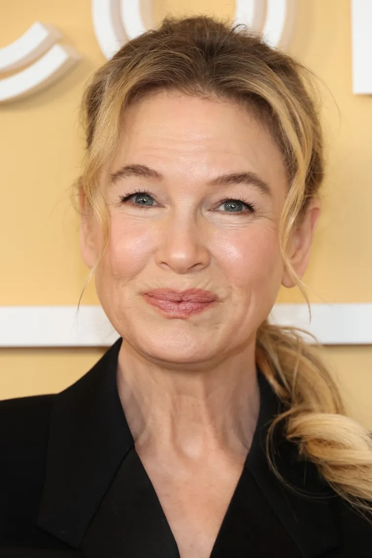 Bridget Jones, jesi to ti? Legendarnu glumicu mnogi vi&scaron;e ne prepoznaju, pretjerala sa zahvatima