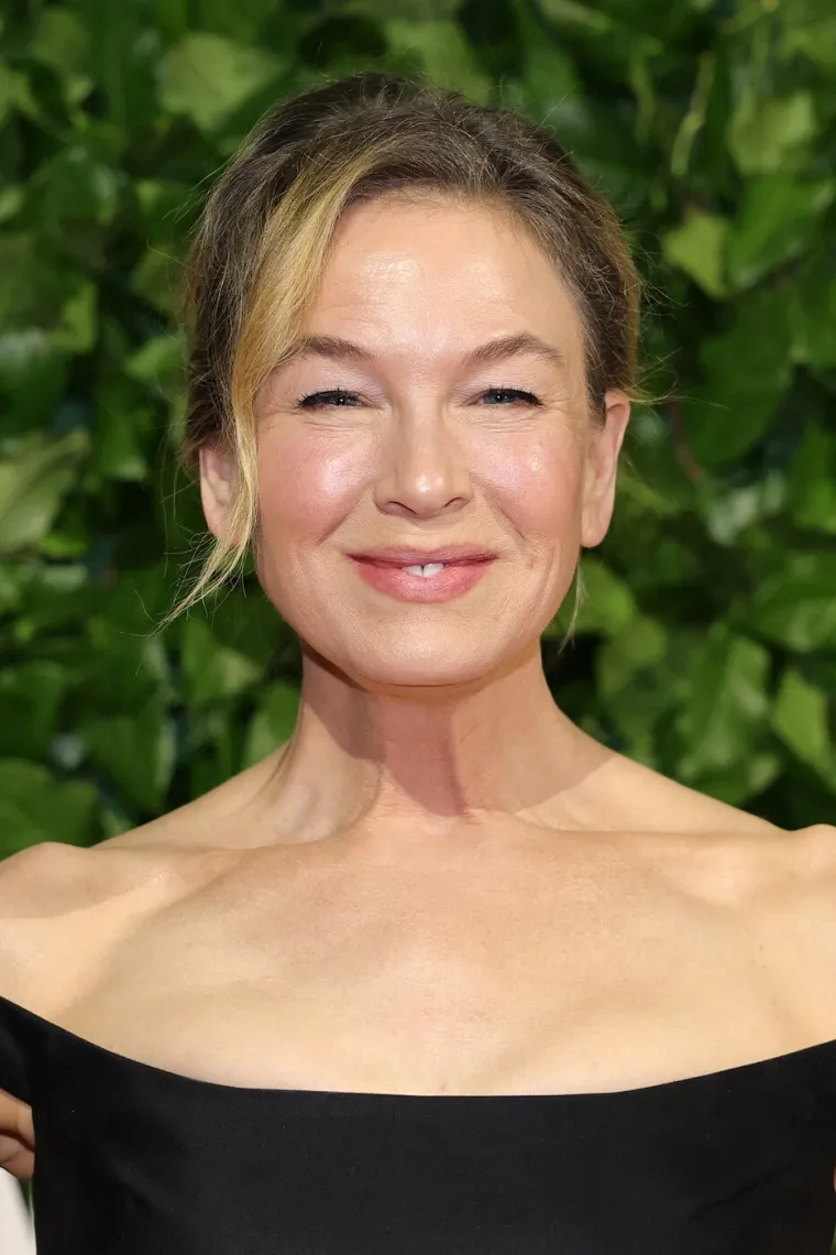 Bridget Jones, jesi to ti? Legendarnu glumicu mnogi vi&scaron;e ne prepoznaju, pretjerala sa zahvatima