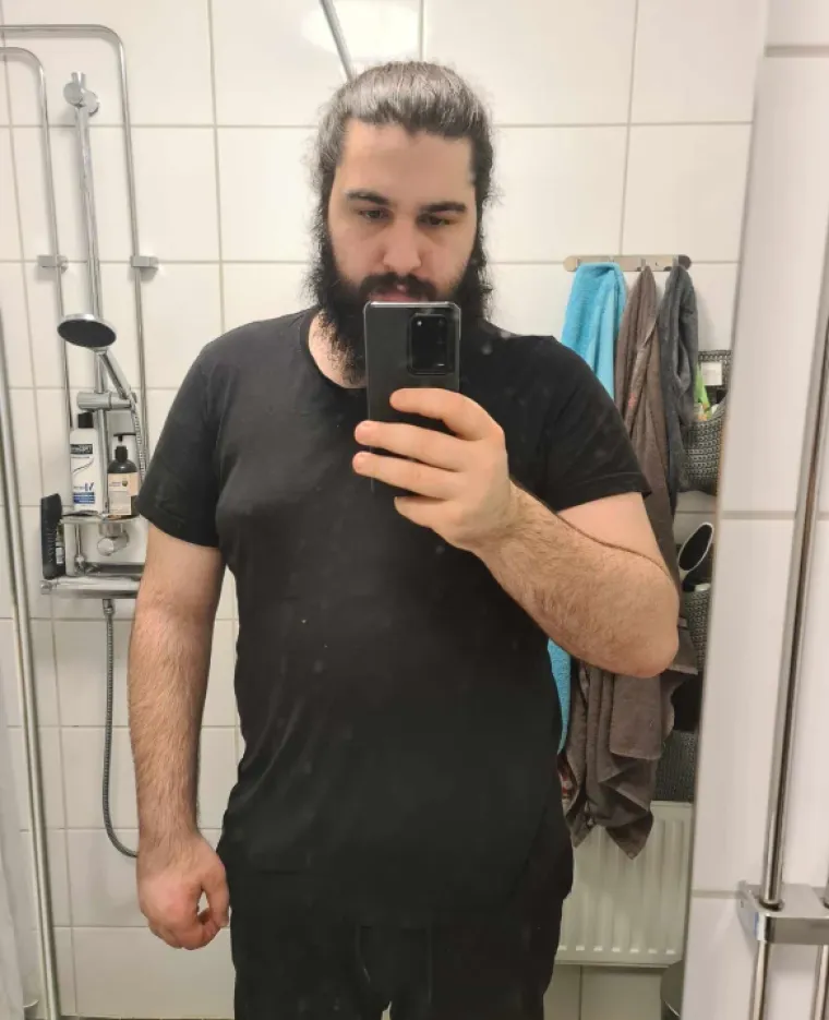 Nevjerojatno koliko se ljudi mogu promijeniti u par godina: Ove osobe vi&scaron;e ne sliče na sebe