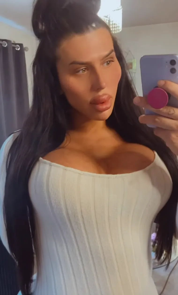 Godinama je punila obraze filerima, a sada je odlučila vratiti prirodno lice: Promjena je ogromna