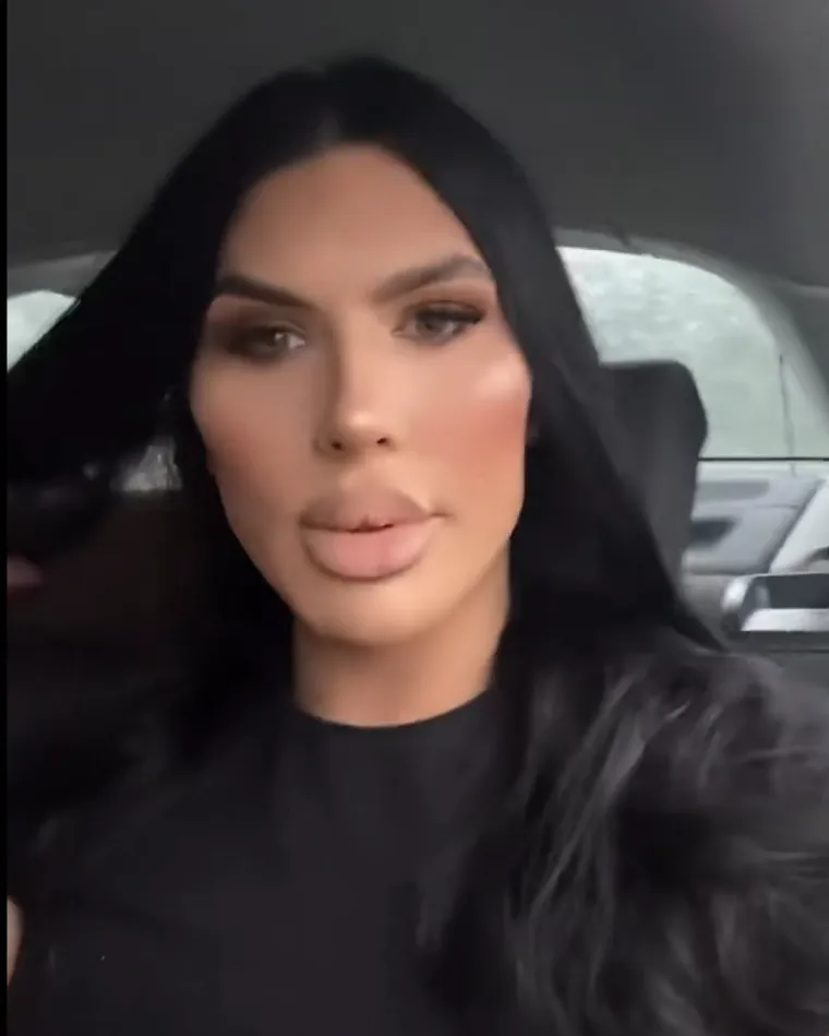 Godinama je punila obraze filerima, a sada je odlučila vratiti prirodno lice: Promjena je ogromna