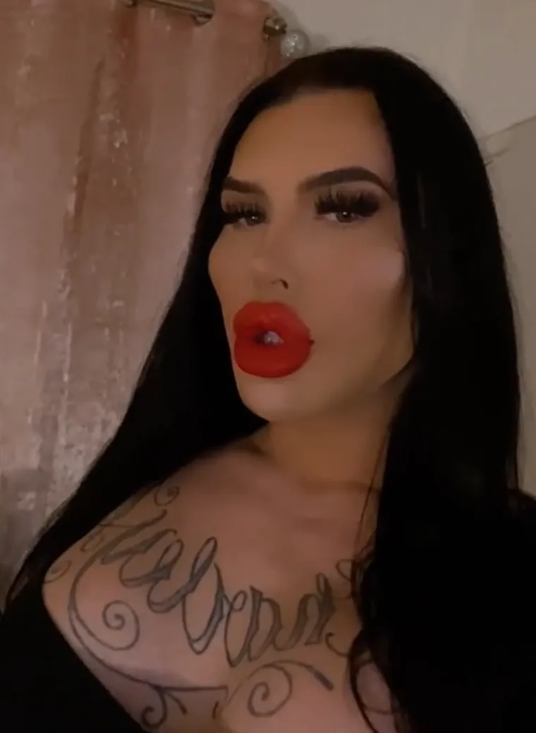 Godinama je punila obraze filerima, a sada je odlučila vratiti prirodno lice: Promjena je ogromna