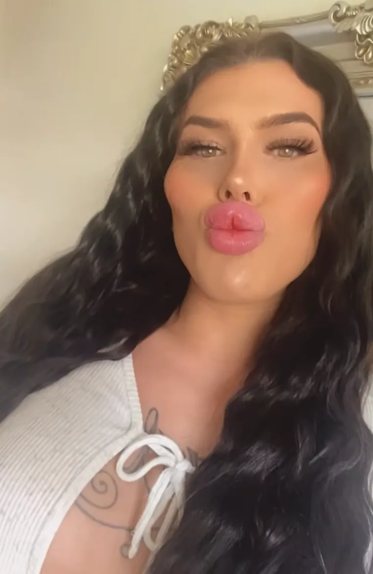 Godinama je punila obraze filerima, a sada je odlučila vratiti prirodno lice: Promjena je ogromna