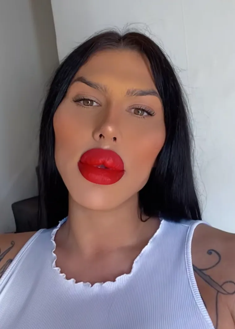 Godinama je punila obraze filerima, a sada je odlučila vratiti prirodno lice: Promjena je ogromna