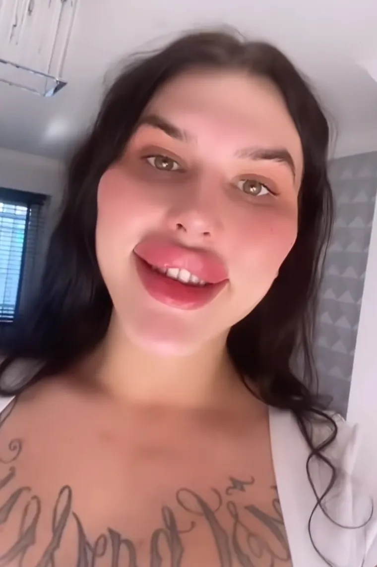 Godinama je punila obraze filerima, a sada je odlučila vratiti prirodno lice: Promjena je ogromna