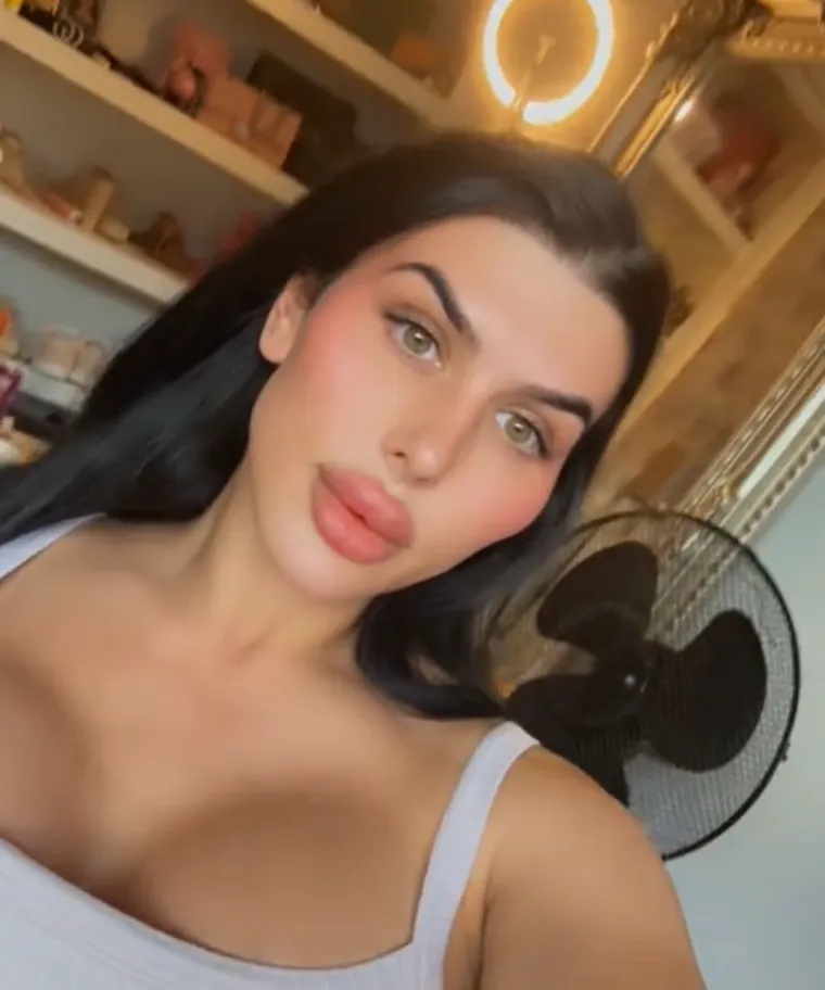 Godinama je punila obraze filerima, a sada je odlučila vratiti prirodno lice: Promjena je ogromna