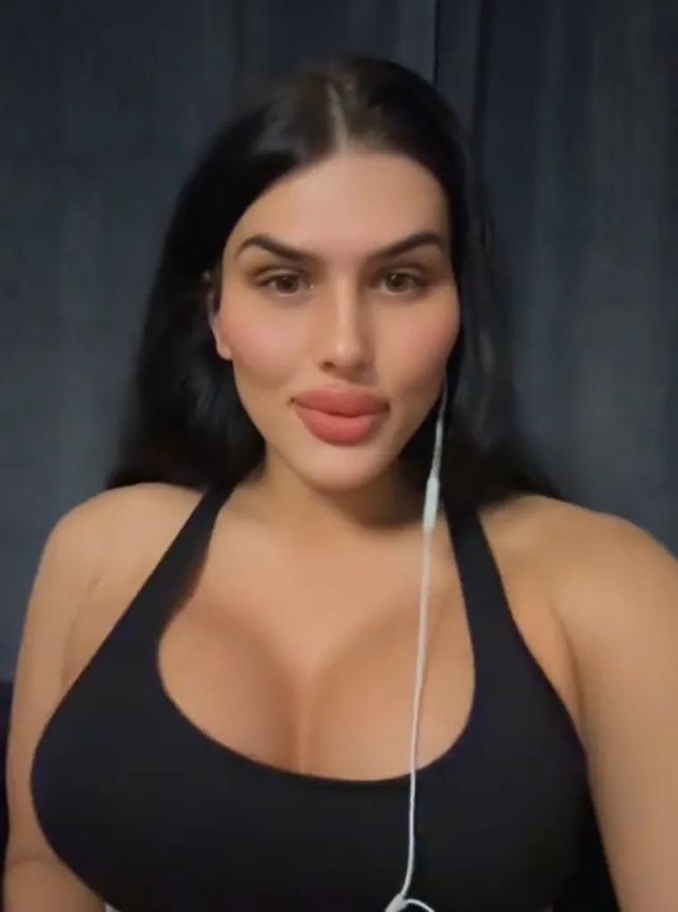 Godinama je punila obraze filerima, a sada je odlučila vratiti prirodno lice: Promjena je ogromna