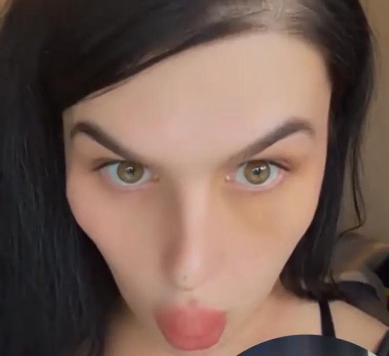 Godinama je punila obraze filerima, a sada je odlučila vratiti prirodno lice: Promjena je ogromna