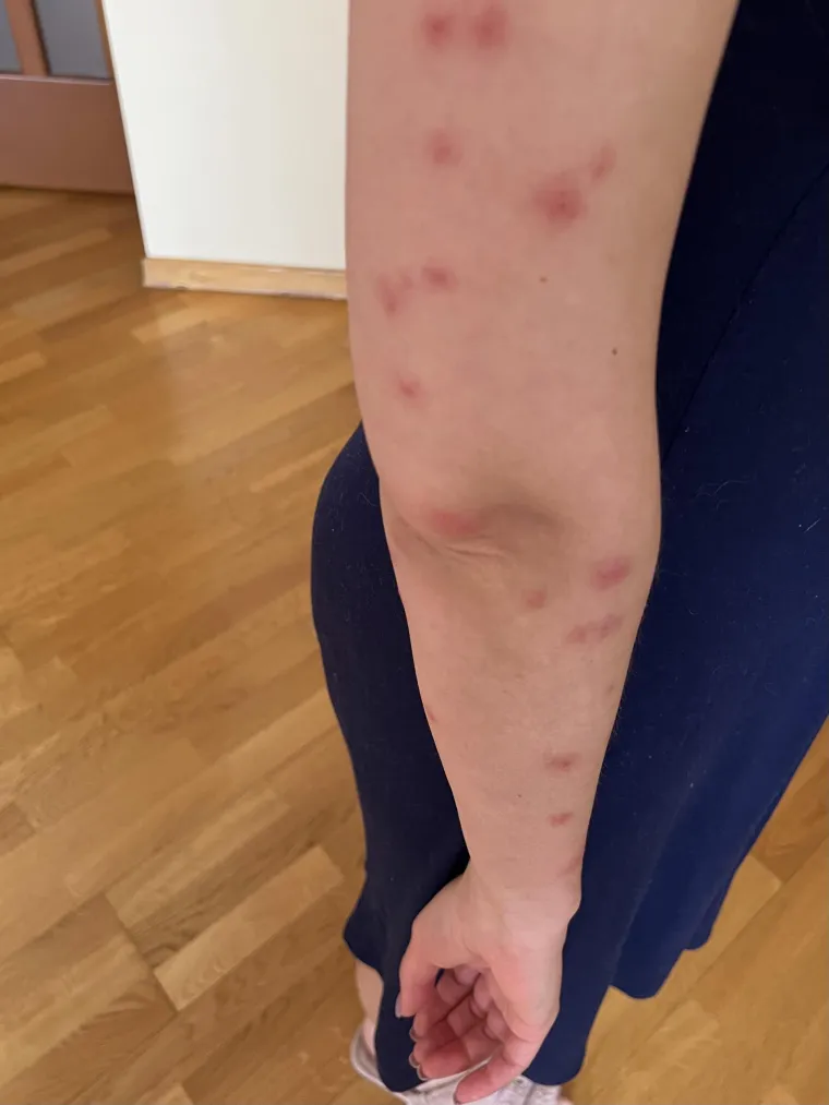 Ovo su zasigurno najgore hotelske sobe u koje su gosti ikad kročili, prizori će vas zgroziti