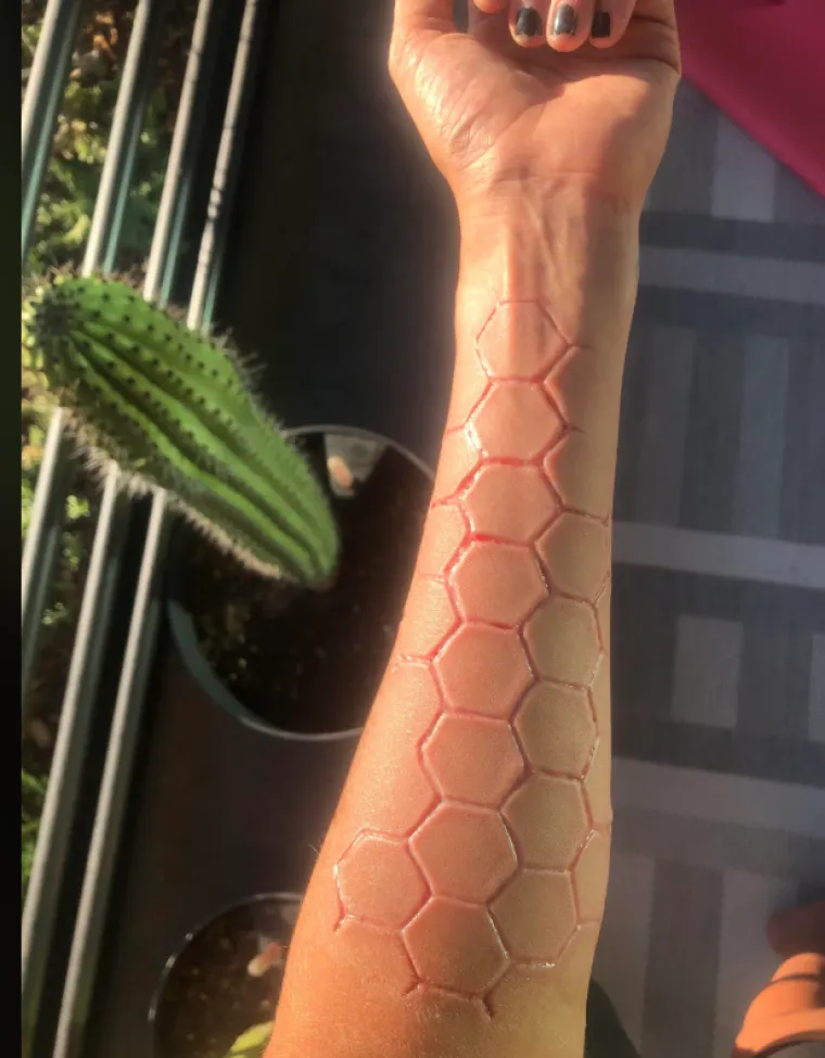 Ljudi su podijelili svoje najbizarnije modifikacije na tijelu: Neke su ba&scaron; zastra&scaron;ujuće