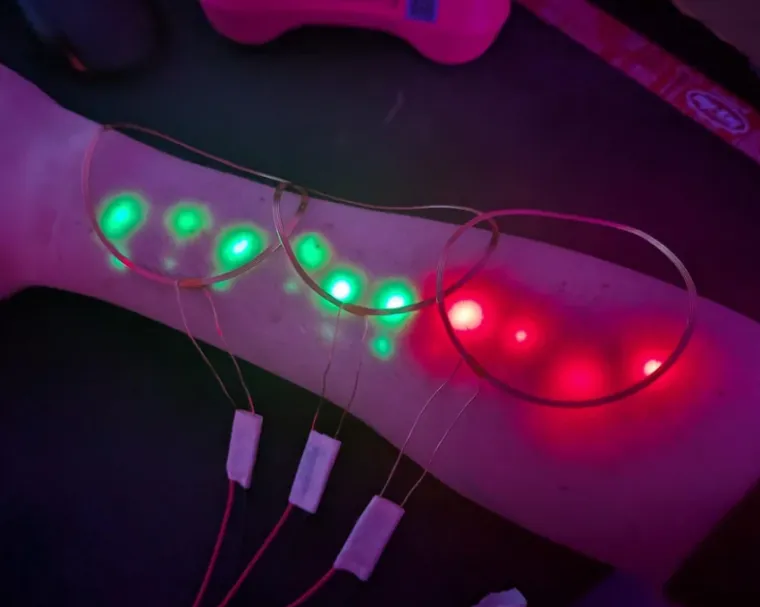 Ljudi su podijelili svoje najbizarnije modifikacije na tijelu: Neke su ba&scaron; zastra&scaron;ujuće