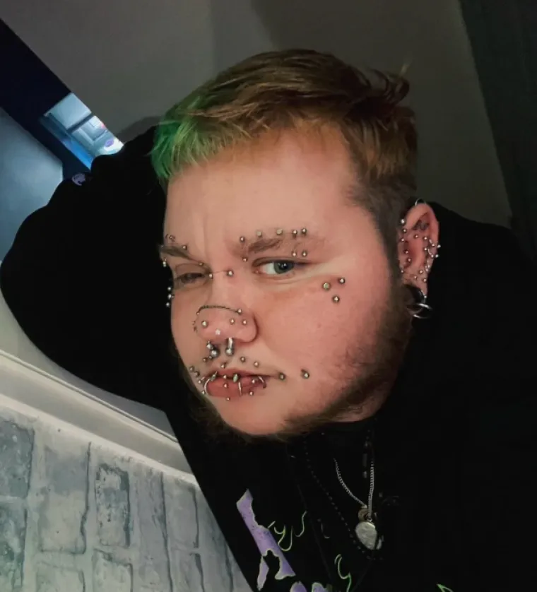 Ljudi su podijelili svoje najbizarnije modifikacije na tijelu: Neke su ba&scaron; zastra&scaron;ujuće