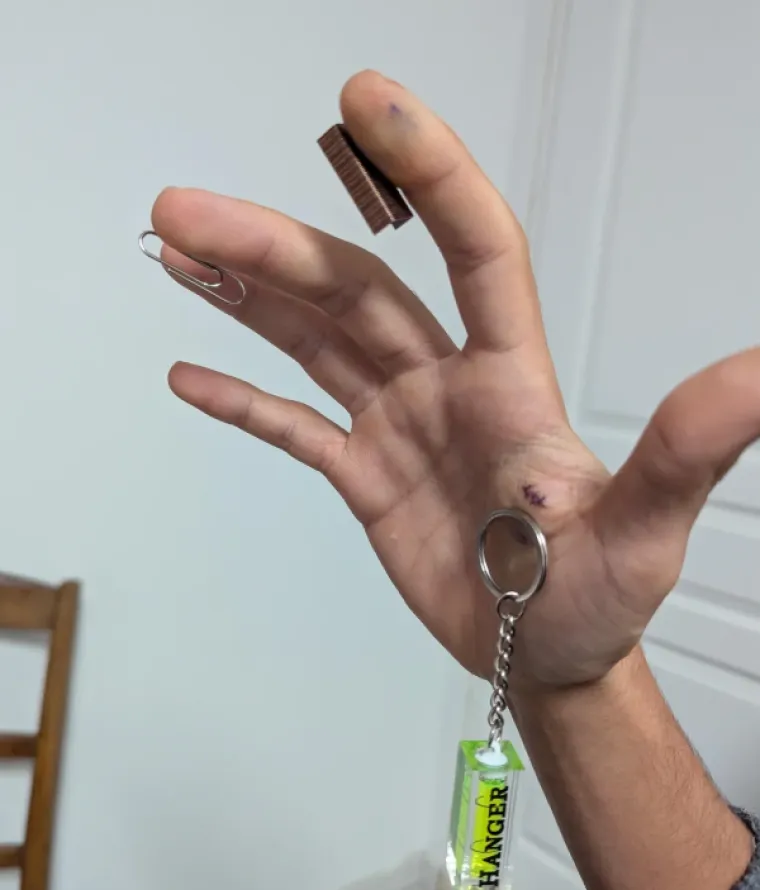 Ljudi su podijelili svoje najbizarnije modifikacije na tijelu: Neke su ba&scaron; zastra&scaron;ujuće