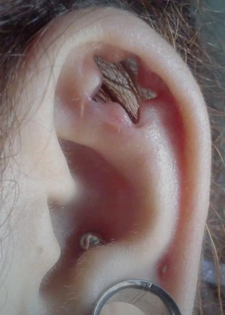 Ljudi su podijelili svoje najbizarnije modifikacije na tijelu: Neke su ba&scaron; zastra&scaron;ujuće