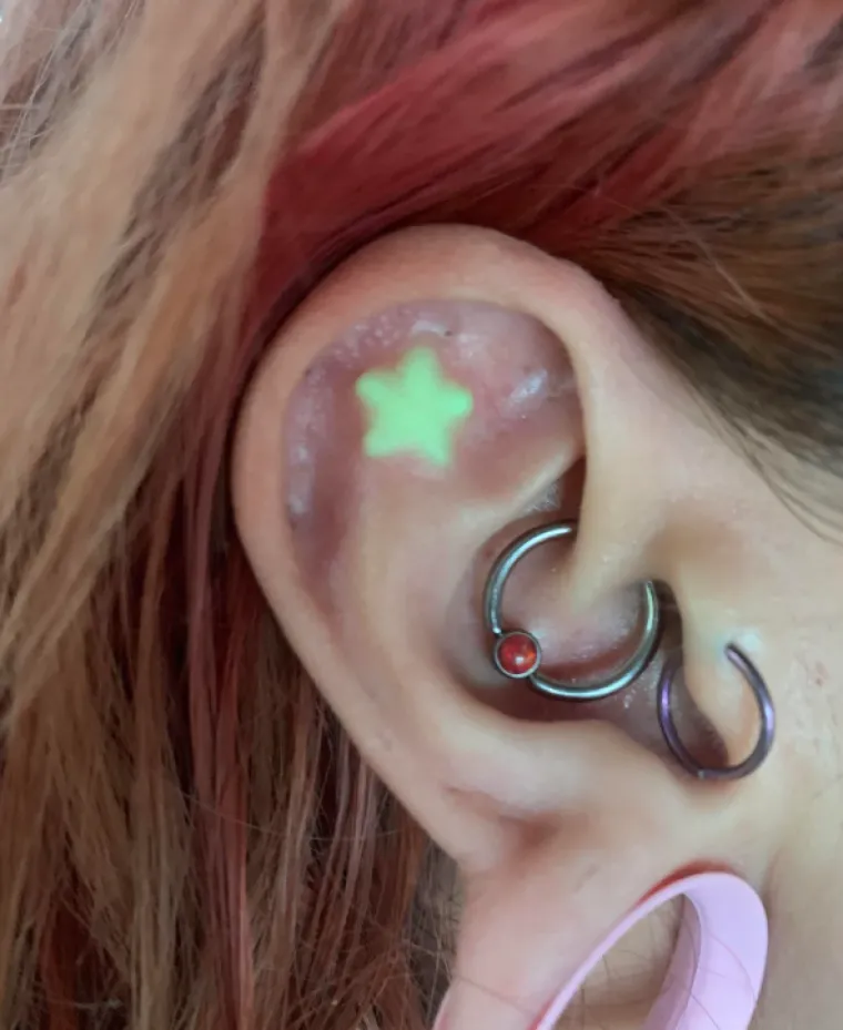 Ljudi su podijelili svoje najbizarnije modifikacije na tijelu: Neke su ba&scaron; zastra&scaron;ujuće