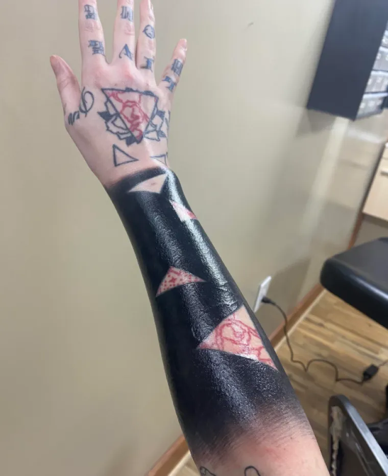 Ljudi su podijelili svoje najbizarnije modifikacije na tijelu: Neke su ba&scaron; zastra&scaron;ujuće