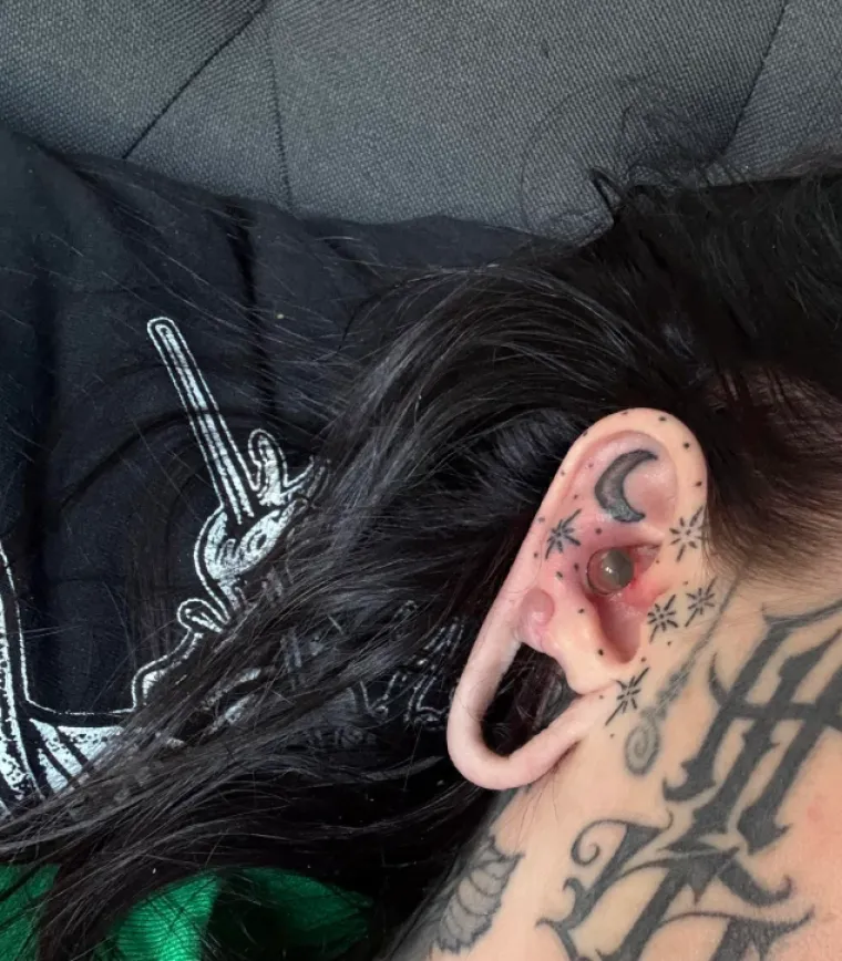 Ljudi su podijelili svoje najbizarnije modifikacije na tijelu: Neke su ba&scaron; zastra&scaron;ujuće