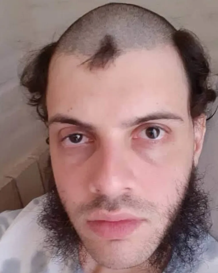 Oti&scaron;li po novu frizuru, iza&scaron;li s razlogom za tužbu: Nevjerojatno kakve su im katastrofe napravili