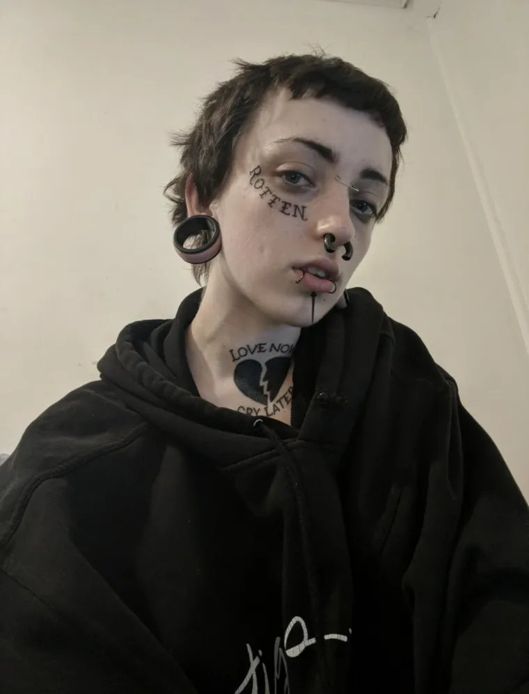 Najteži period u životu doveo je do ekstremnog zahvata: Evo kako danas izgleda