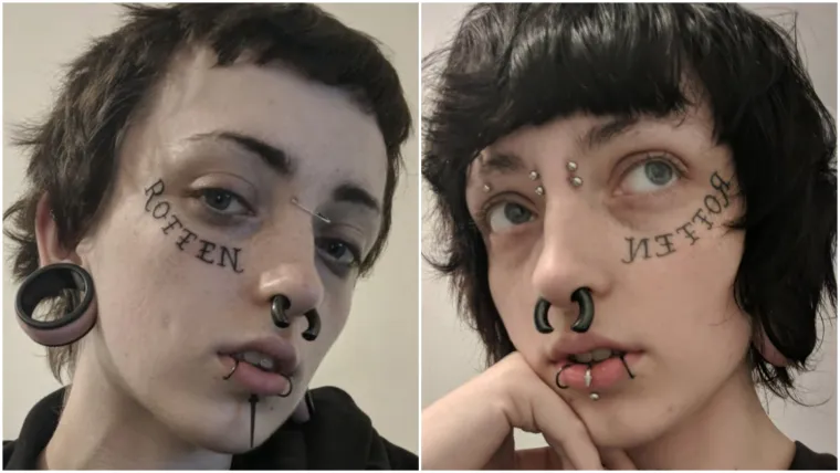 Najteži period u životu doveo je do ekstremnog zahvata: Evo kako danas izgleda