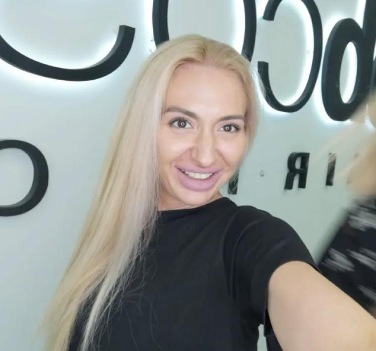 Ponosno nosi titulu žene s najvećim obrazima: Prije je bila prava ljepotica, evo kako je izgledala