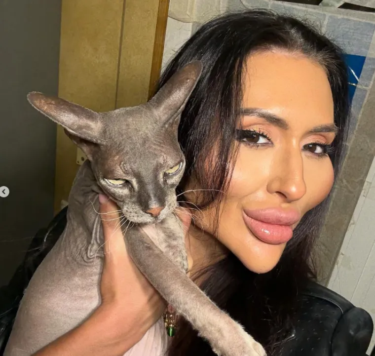 Ponosno nosi titulu žene s najvećim obrazima: Prije je bila prava ljepotica, evo kako je izgledala