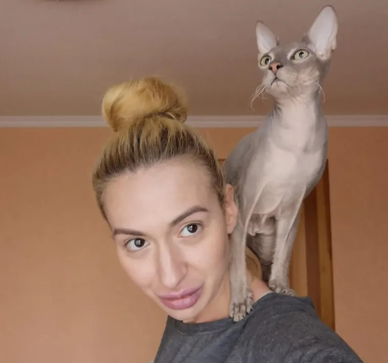 Ponosno nosi titulu žene s najvećim obrazima: Prije je bila prava ljepotica, evo kako je izgledala