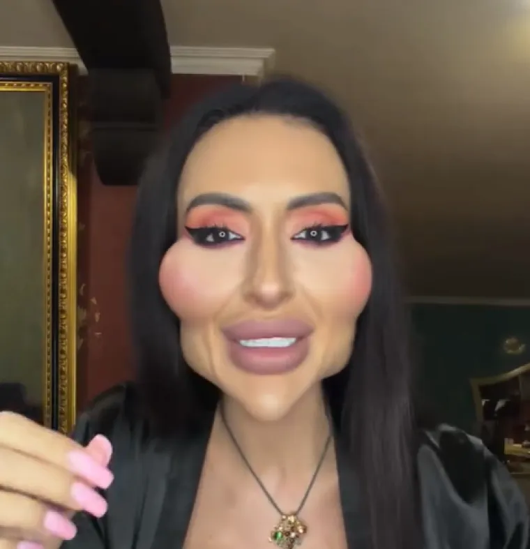 Ponosno nosi titulu žene s najvećim obrazima: Prije je bila prava ljepotica, evo kako je izgledala