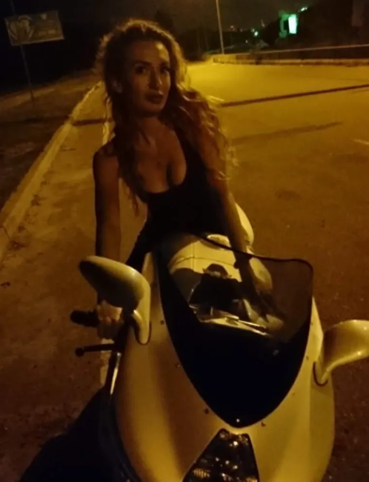 Ponosno nosi titulu žene s najvećim obrazima: Prije je bila prava ljepotica, evo kako je izgledala