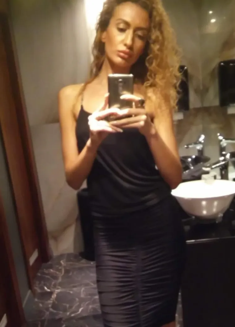 Ponosno nosi titulu žene s najvećim obrazima: Prije je bila prava ljepotica, evo kako je izgledala